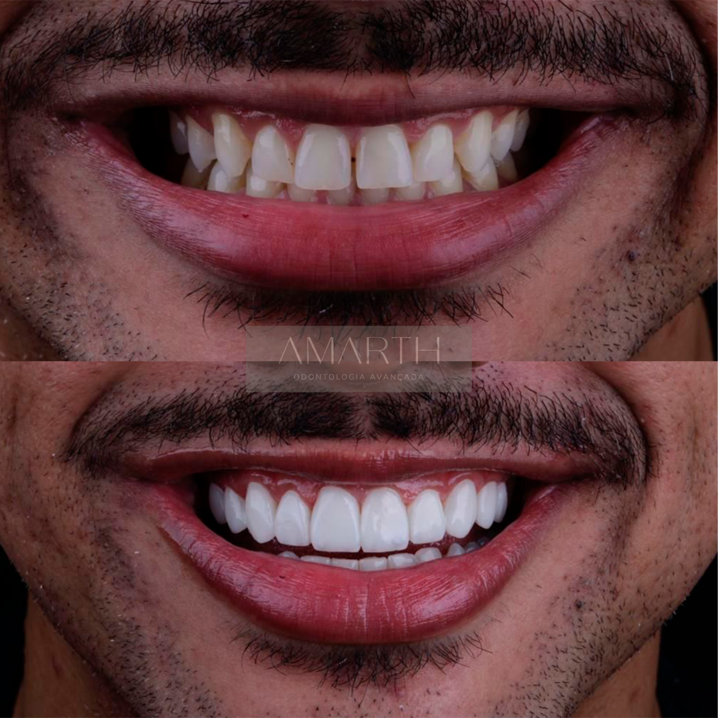 Dentista em Mogi Mirim - Amarth Odontologia - Implante, lentes de contato, facetas, protese, aparelho dentário em Mogi Mirim