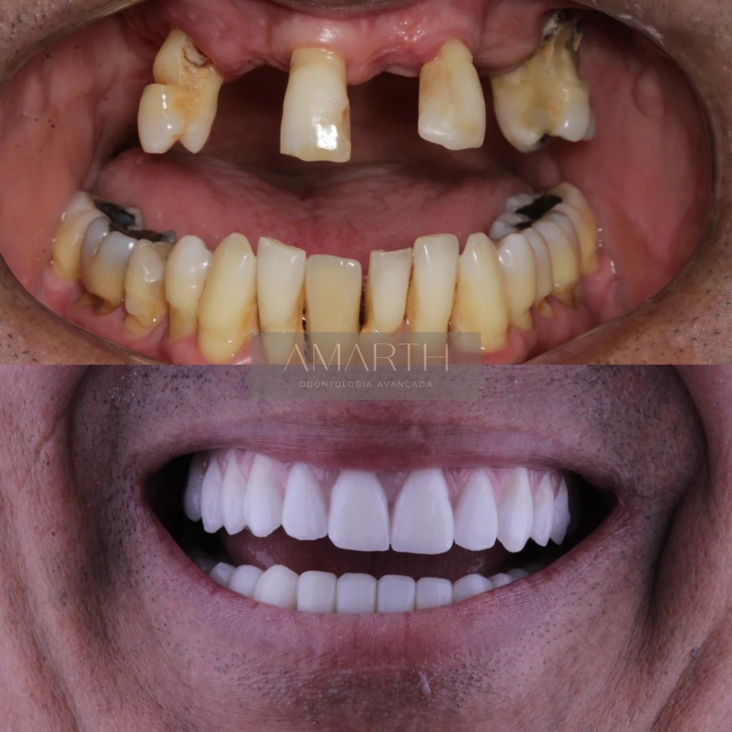 Dentista em Mogi Mirim - Amarth Odontologia - Implante, lentes de contato, facetas, protese, aparelho dentário em Mogi Mirim