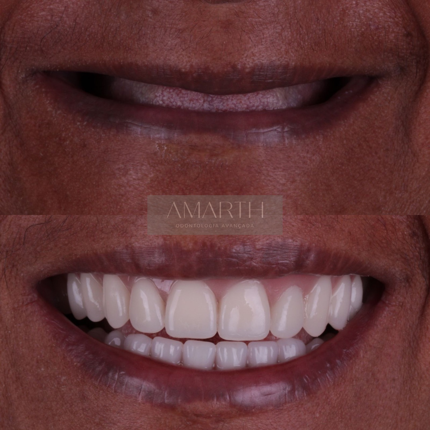 Dentista em Mogi Mirim - Amarth Odontologia - Implante, lentes de contato, facetas, protese, aparelho dentário em Mogi Mirim