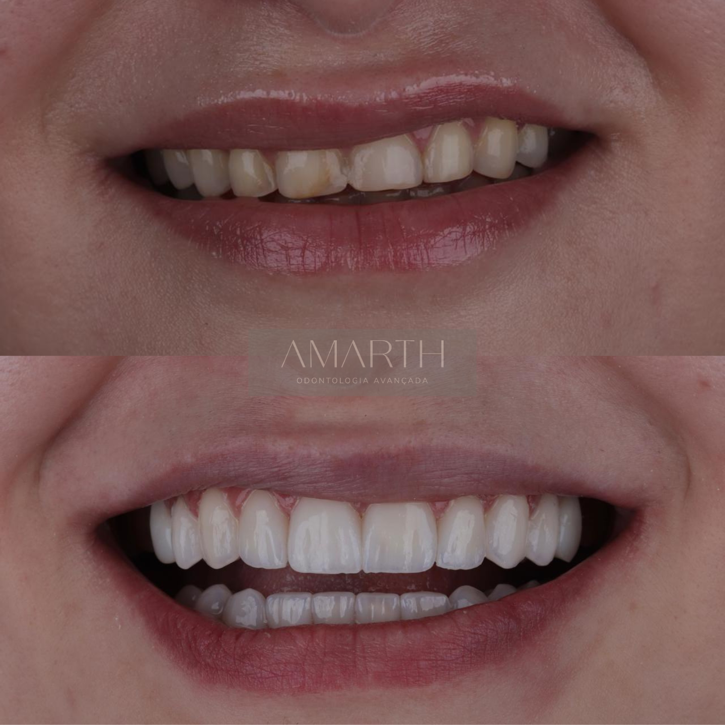 Dentista em Mogi Mirim - Amarth Odontologia - Implante, lentes de contato, facetas, protese, aparelho dentário em Mogi Mirim