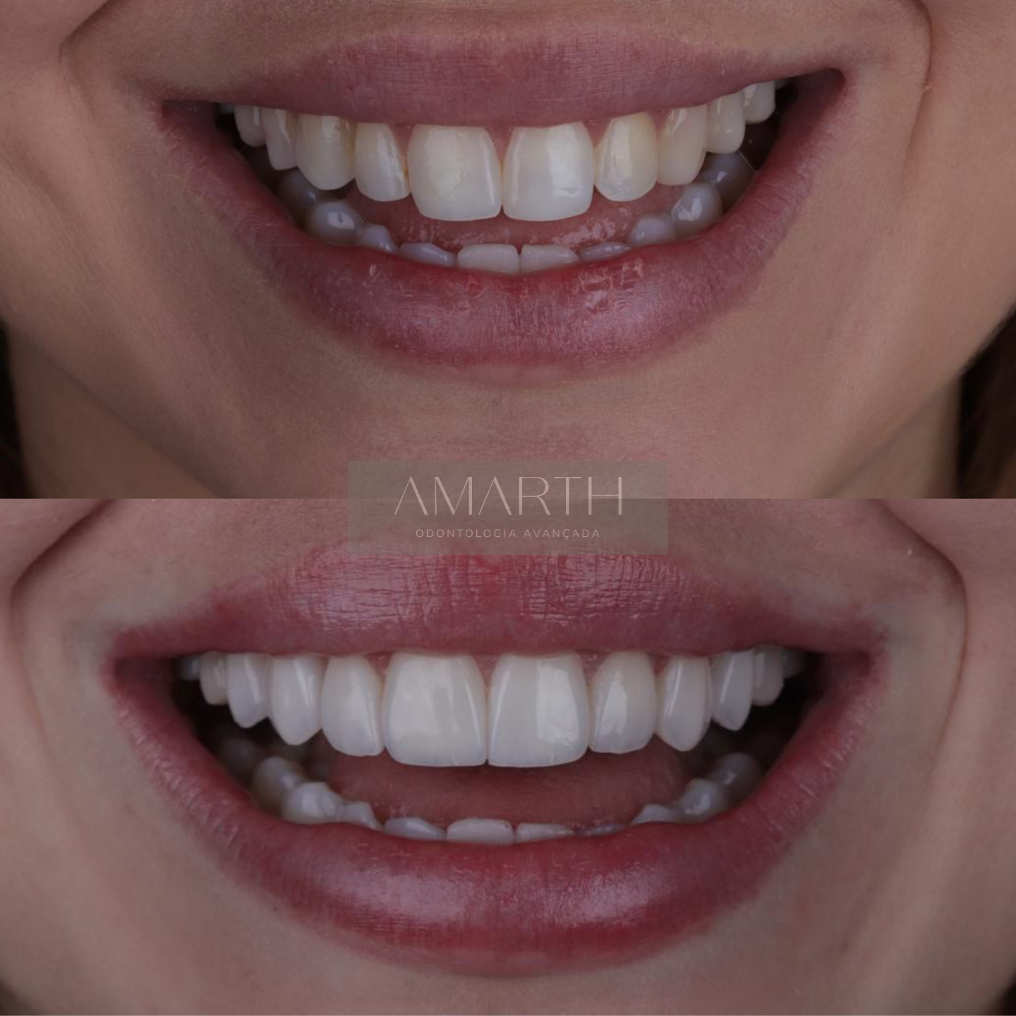 Dentista em Mogi Mirim - Amarth Odontologia - Implante, lentes de contato, facetas, protese, aparelho dentário em Mogi Mirim